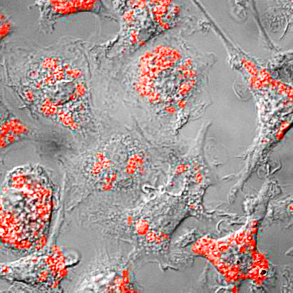 Macrophages (cells used by the immune system to destroy bacterial cells) battling drug-resistant Staphylococcus aureus (marked with red). Photo courtesy of David Heinrichs 